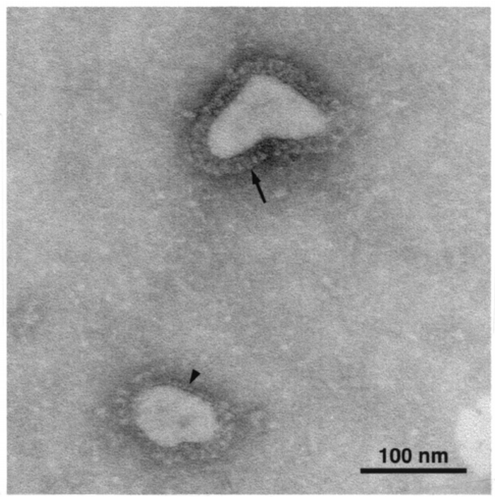 coronavirus taille paricule