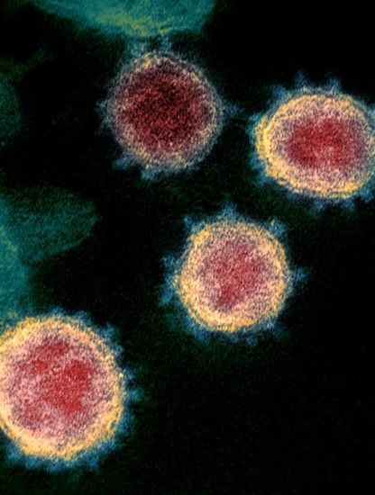liaison forte coronavirus récepteur humain