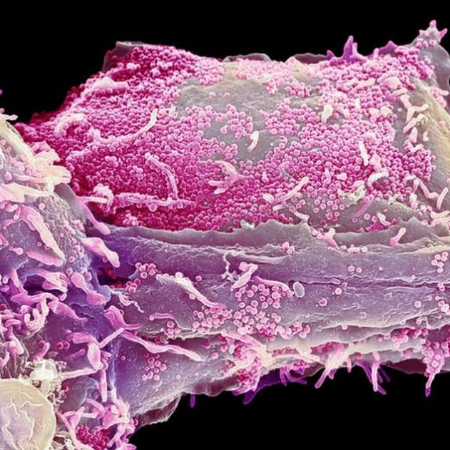 cellule herpès alzheimer
