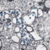 coronavirus sars cov 2 covid19