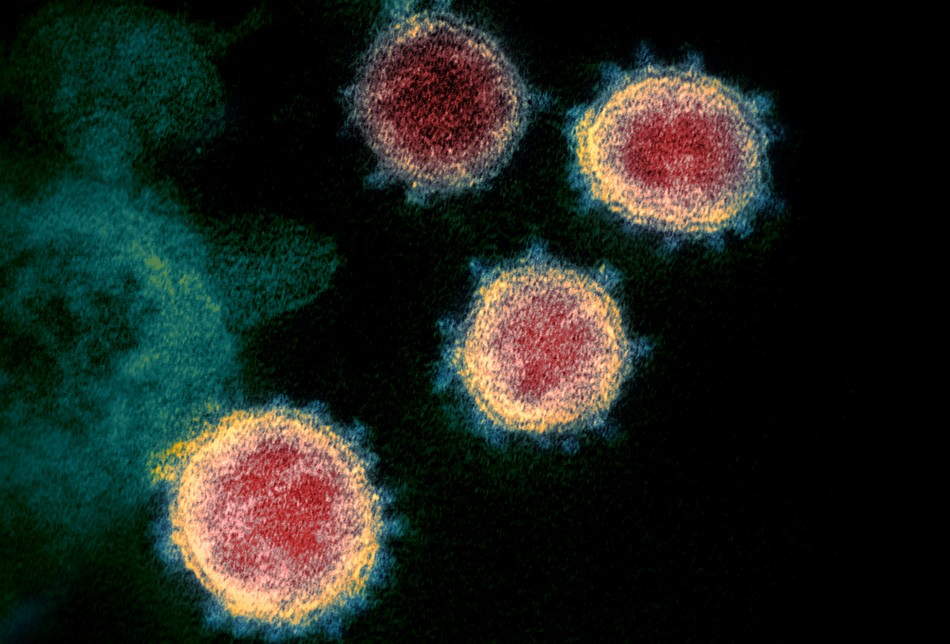 coronavirus proteine pointe covid-19 sars-cov-2 virus
