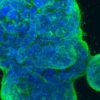 cancer sein modele murin culture cellules humaines