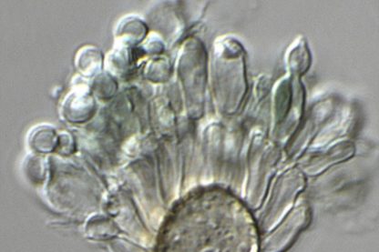 champignon hybride Aspergillus infections pulmonaires