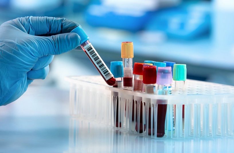 test sanguin sang cancer maladie detection diagnostic precoce rapide