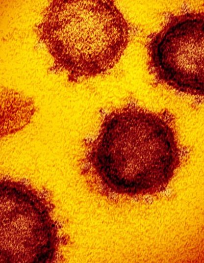 virus pandemie coronavirus sars-cov-2 covid-19