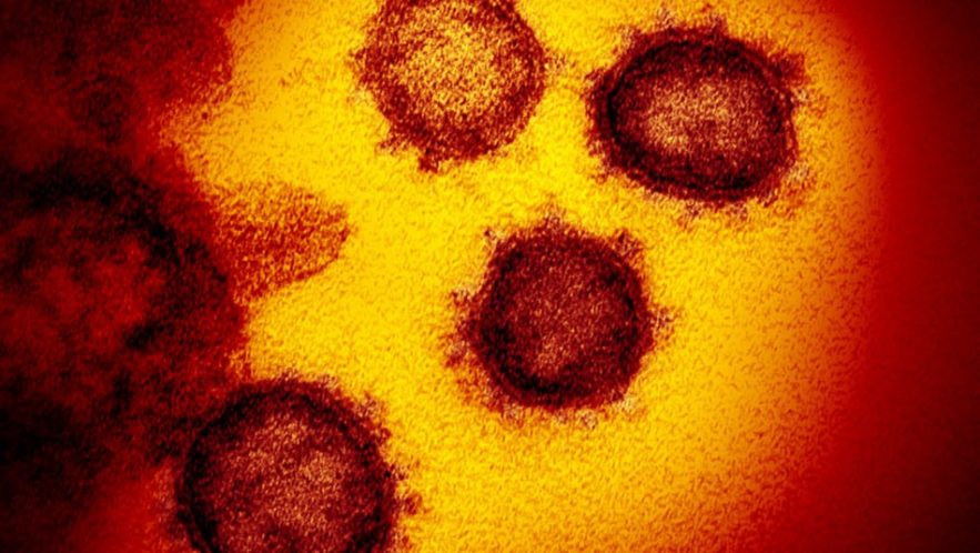 virus pandemie coronavirus sars-cov-2 covid-19
