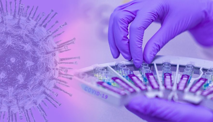 chercheurs rejettent nouvelles affirmations coronavirus cree laboratoire
