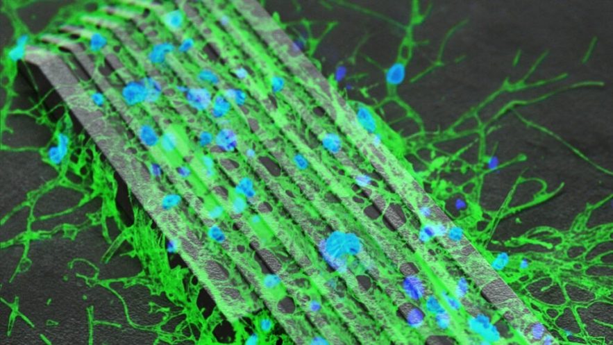 microrobots rétablissement communications entre cellules neurones