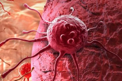 nouveau traitement expérimental détruit cellules cancéreuses sans médicament couv