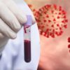groupes sanguins impact sévérité risques infection coronavirus couv