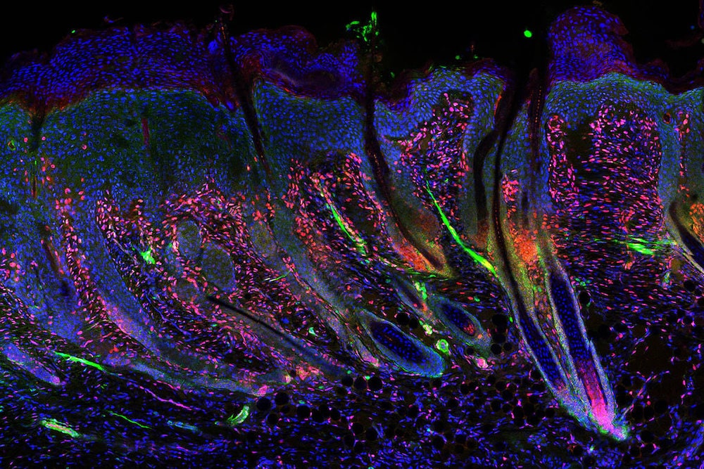 image plaie regeneree follicules pileux