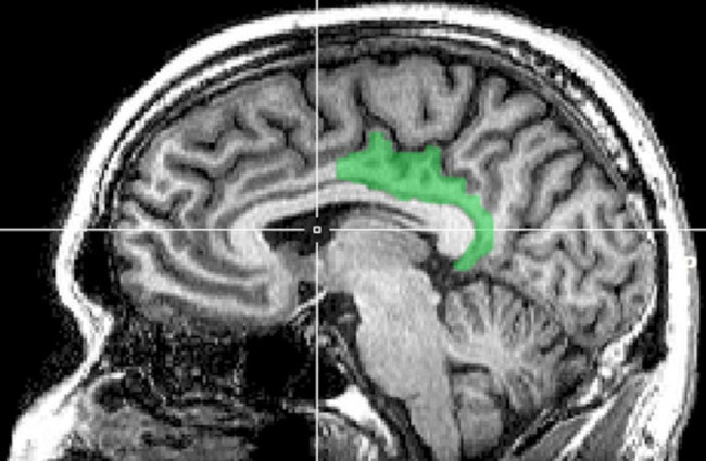 cerveau cortex cingulaire postérieur