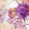 chercheurs identifient neurones vulnerables maladie alzheimer