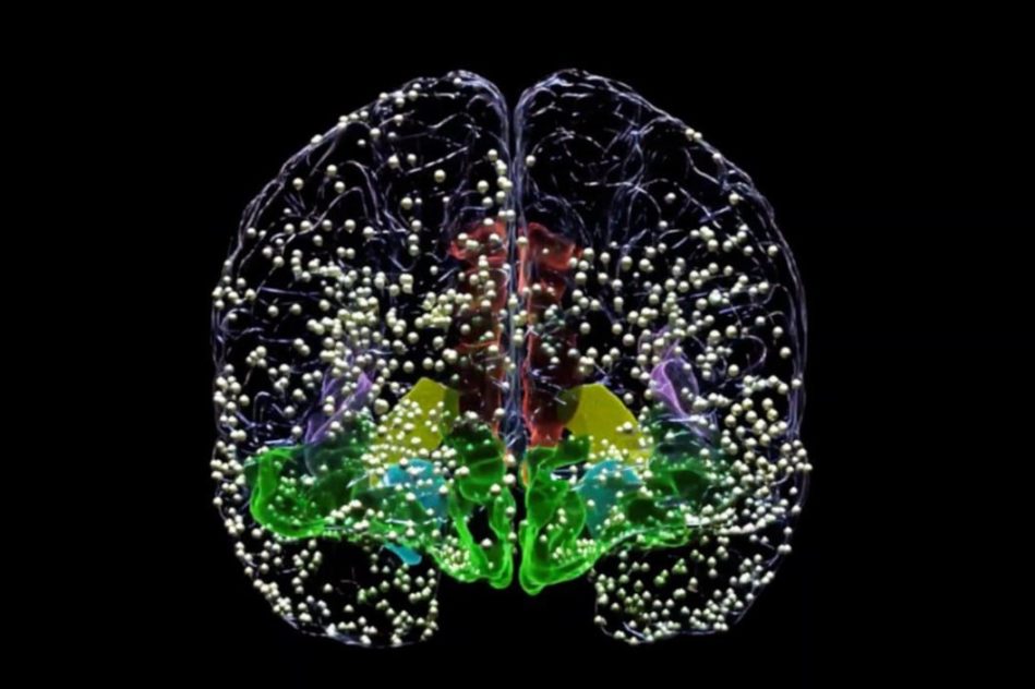 stimulation ciblée traitement dépression