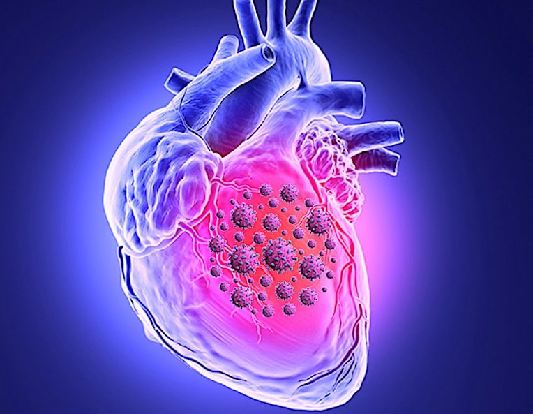 sars-cov-2 peut tuer cellules muscle cardiaque interferer avec contraction