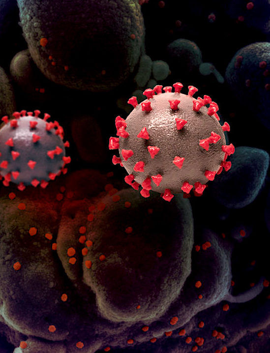 medicament emprisonne coronavirus dans cellules