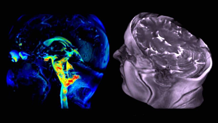 nouvelle technique imagerie capture mouvement cerebral avec precision etonnante