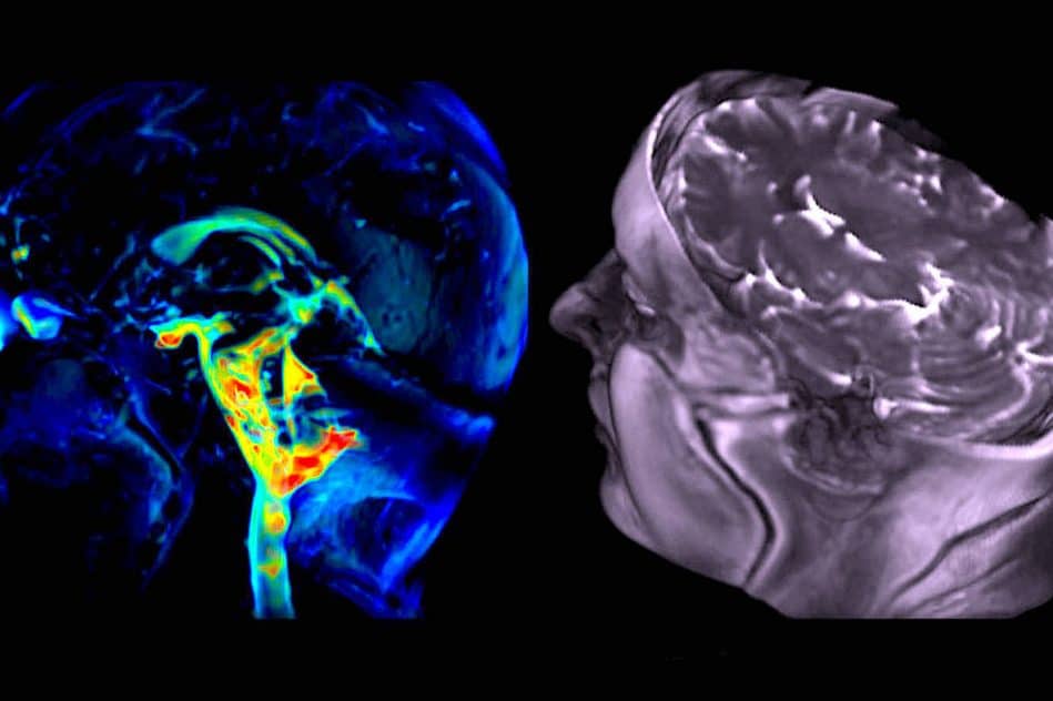nouvelle technique imagerie capture mouvement cerebral avec precision etonnante