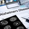 alzheimer vaccin passe succes essais cliniques phase 2