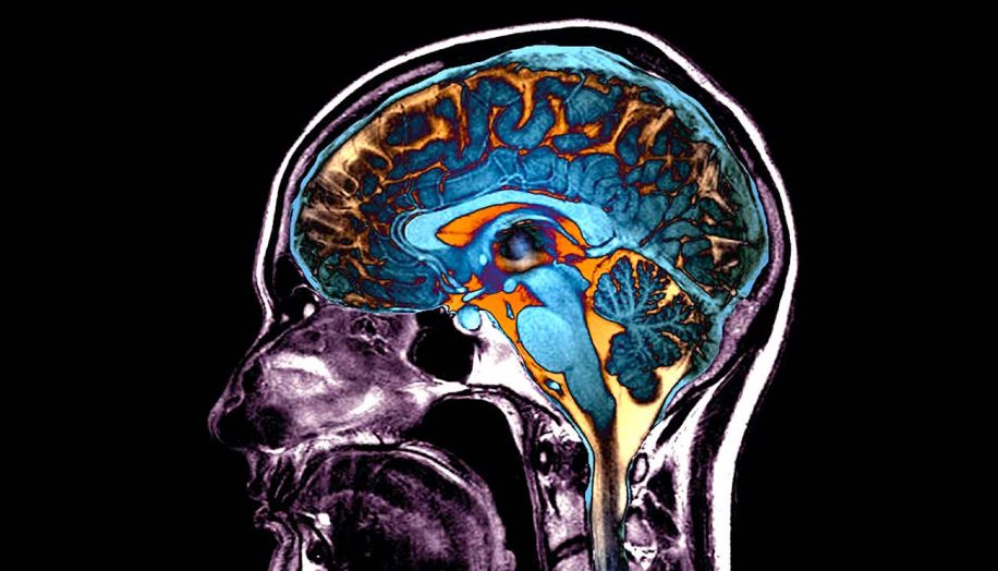 modifications cerebrales provoquees par covid impact sur conscience cognition