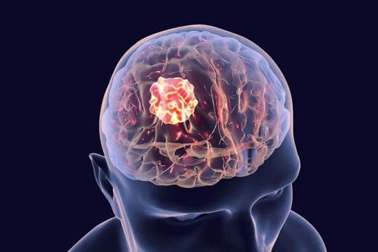 structures cancers cerebraux peuvent aider combattre tumeurs