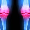 hydrogel injectable regenerer cartilage endommage articulations