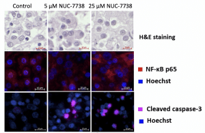 anti-cancer effect of NUC-7738 tissue