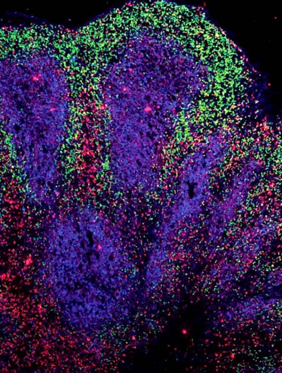 mini cerveaux laboratoire revelent possibilites traitement maladies motoneurone
