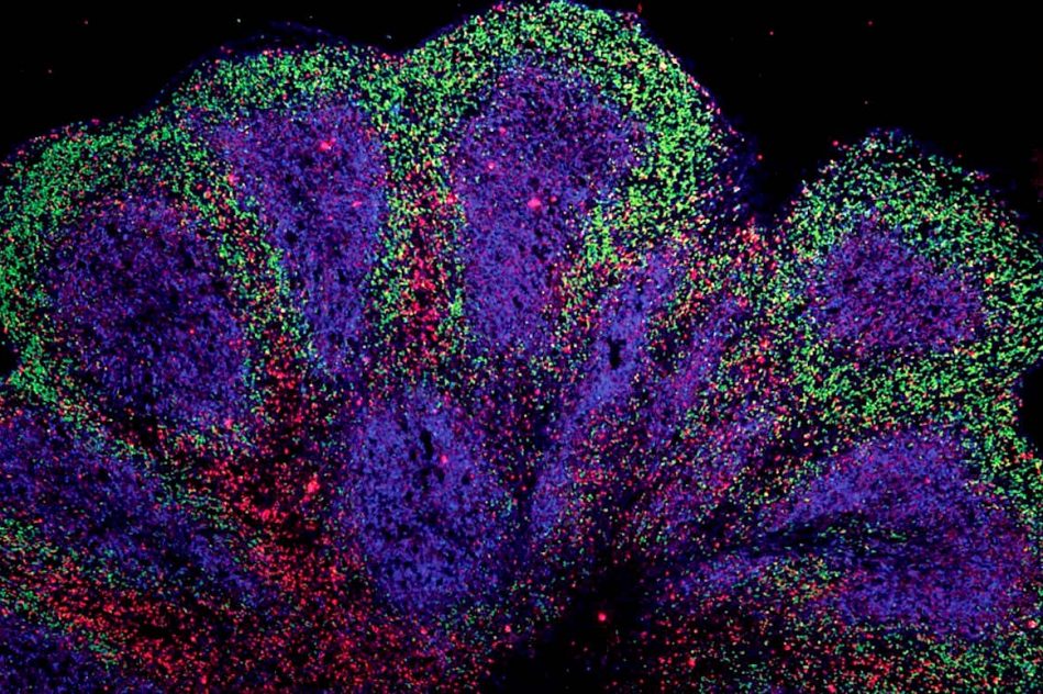 mini cerveaux laboratoire revelent possibilites traitement maladies motoneurone