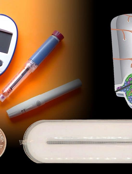 diabete type 1 nouveau traitement secreteur insuline