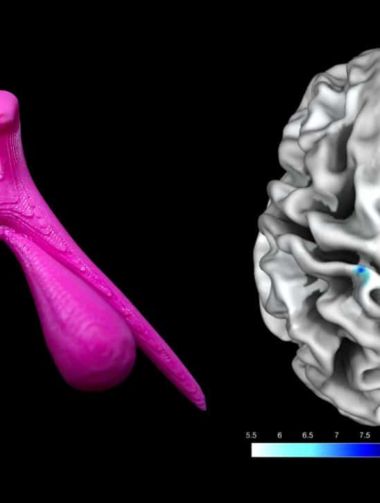 premiere fois scientifiques identifient region cerebrale associee stimulation clitoris