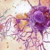 traitement cellules immunitaires cerveau alzheimer