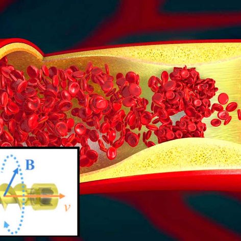 microrobot helicoidal nage dans vaisseaux sanguins pour nettoyer
