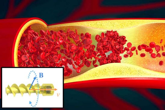 microrobot helicoidal nage dans vaisseaux sanguins pour nettoyer