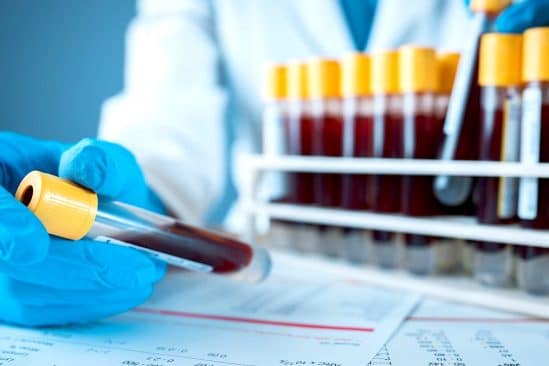 test sanguin detection cancer precocement