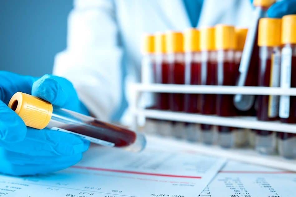 test sanguin detection cancer precocement