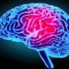 origine cerebrale schizophrenie gyrus dente