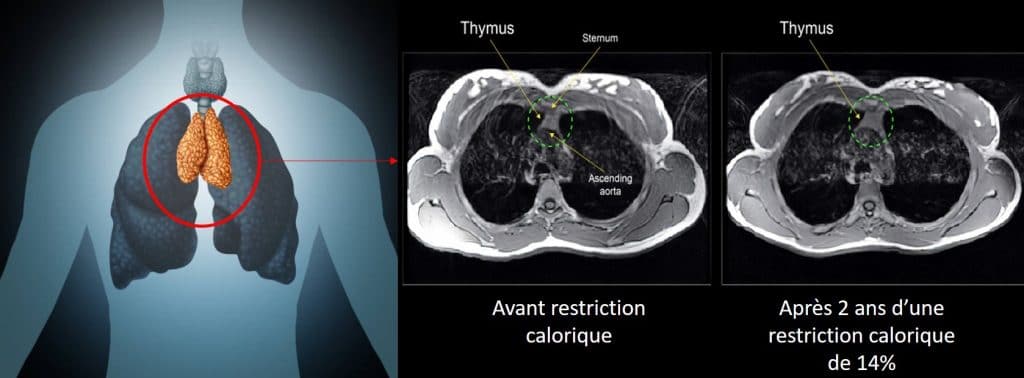 thymus anti age restriction calorique