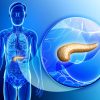 cancer pancreas remede molecule ferroptose
