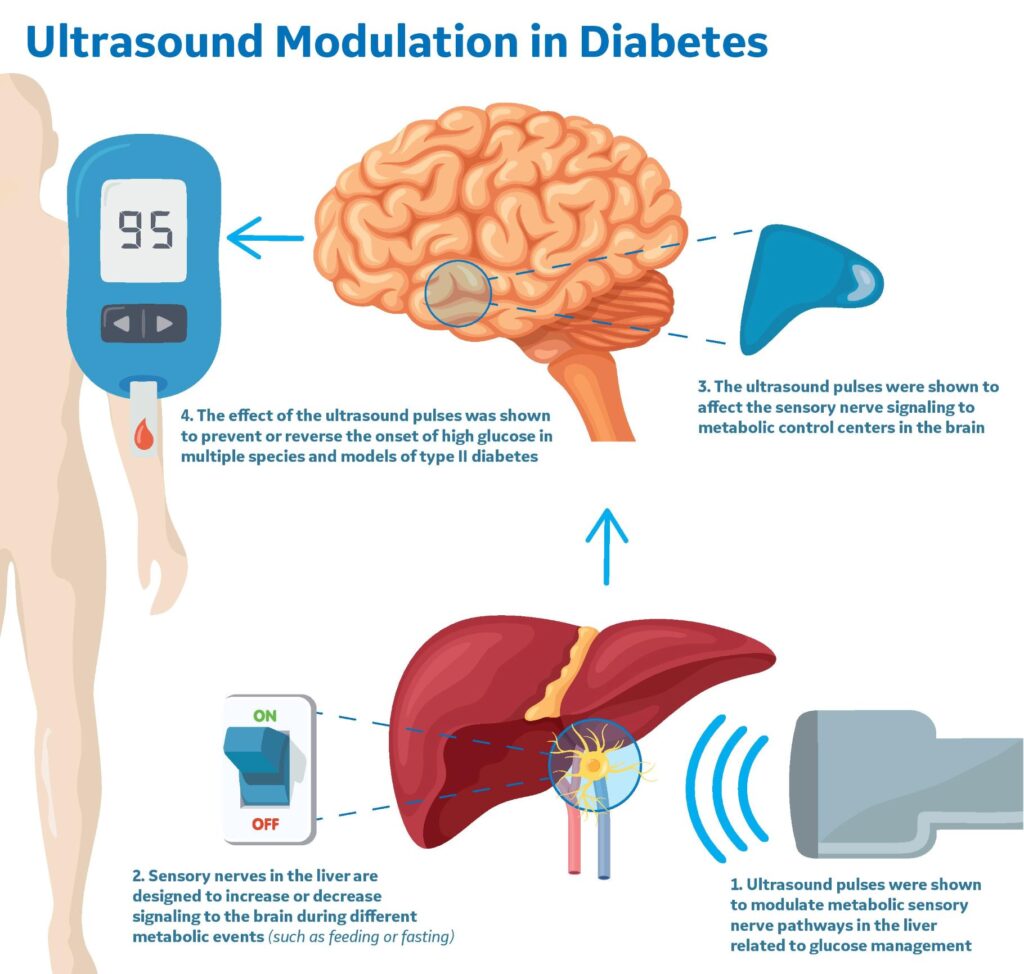 infographie ultrasons traitement diabete