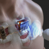 ultrasons recharge implants cardiaques sous marins
