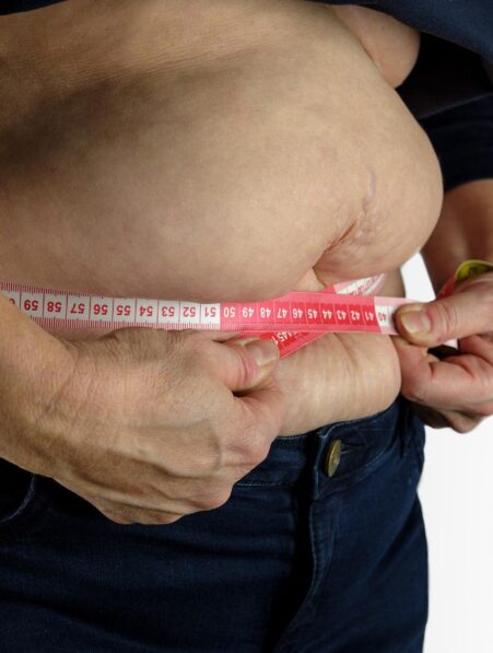 traitement obésité 24kg