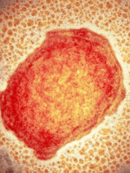 variole du singe epidemie monde zoonose couv