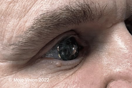 premieres lentilles réalité augmentée testées être humain