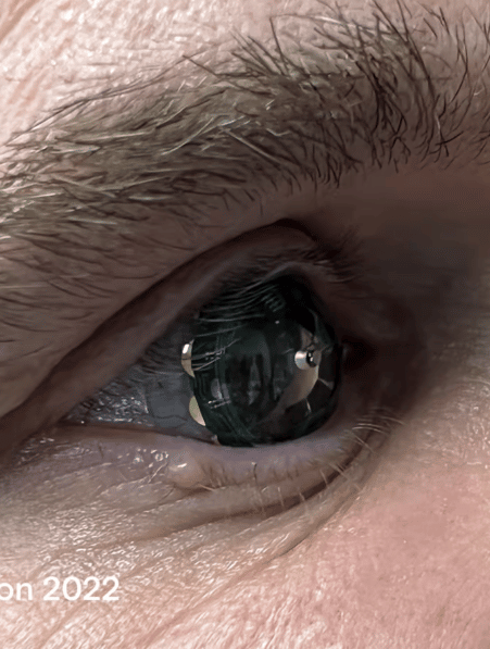 premieres lentilles réalité augmentée testées être humain