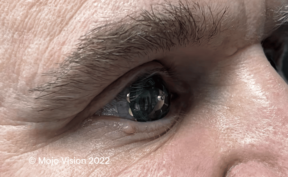 premieres lentilles réalité augmentée testées être humain