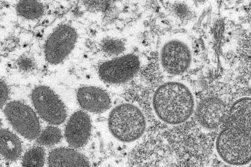 variole singe epidemie evolution acceleree virus