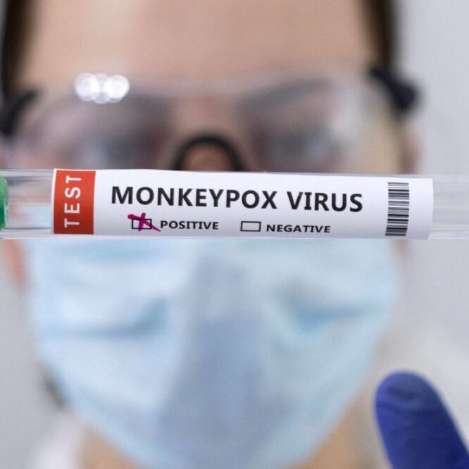 explosion nombre cas variole singe oms preoccupee juillet couv
