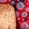 variole singe urgence sanitaire internationale transmission sexuelle couv
