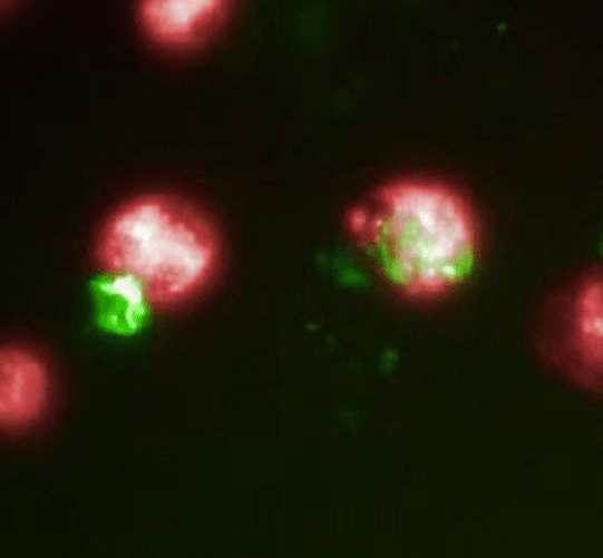 macrophage modifie cellule tumorale